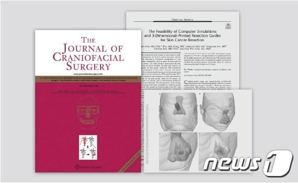 애니메디솔루션은 최근 국제 학술지 &#39;두개안면외과학회지&#40;Journal of Craniofacial Surgery&#41;&#39;에 피부암 수술 시 환자 맞춤형 수술 가이드를 이용하면 종양 절제면을 보다 정확하게 표시할 수 있다는 내용의 논문이 수록됐다고 밝혔다. &#40;애니메디솔루션 제공&#41;