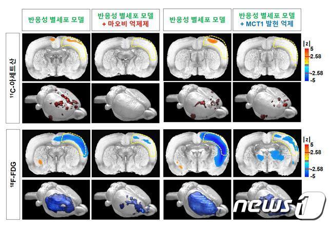 반응성 별세포 동물 모델에서 PET 영상 촬영을 통해 관찰되는 11C-아세트산 흡수 증가와 18F-FDG 흡수 감소. &#40;기초과학연구원 제공&#41; 