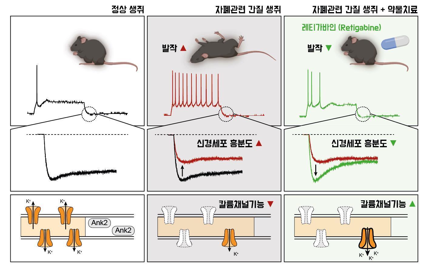 약물치료를 통한 자폐 관련 뇌전증 증상 완화&#40;IBS 제공&#41;/뉴스1