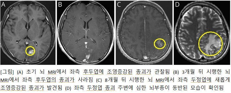  서울대병원 제공/뉴스1 ⓒ News1