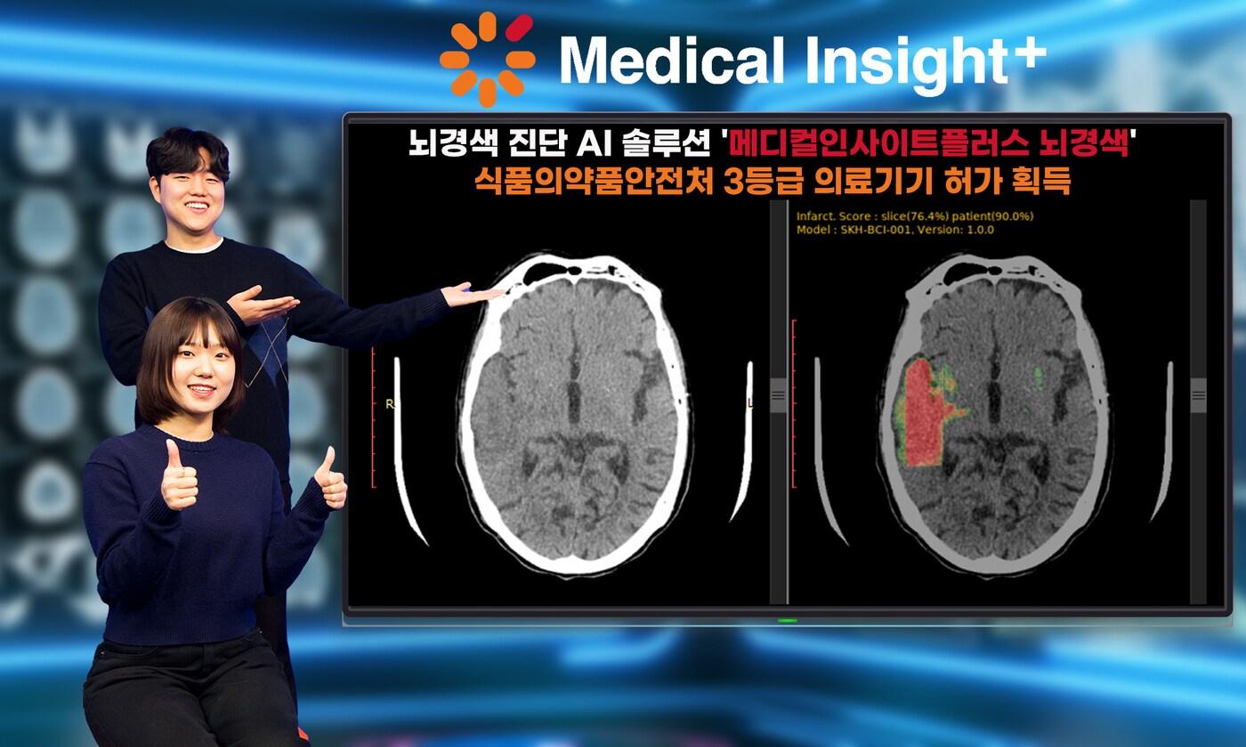 SK C&C는 22일 뇌경색 진단 AI솔루션이 식품의약품안전처 허가를 획득했다고 밝혔다.&#40;SK C&C 제공&#41; 2024.02.22 /뉴스1