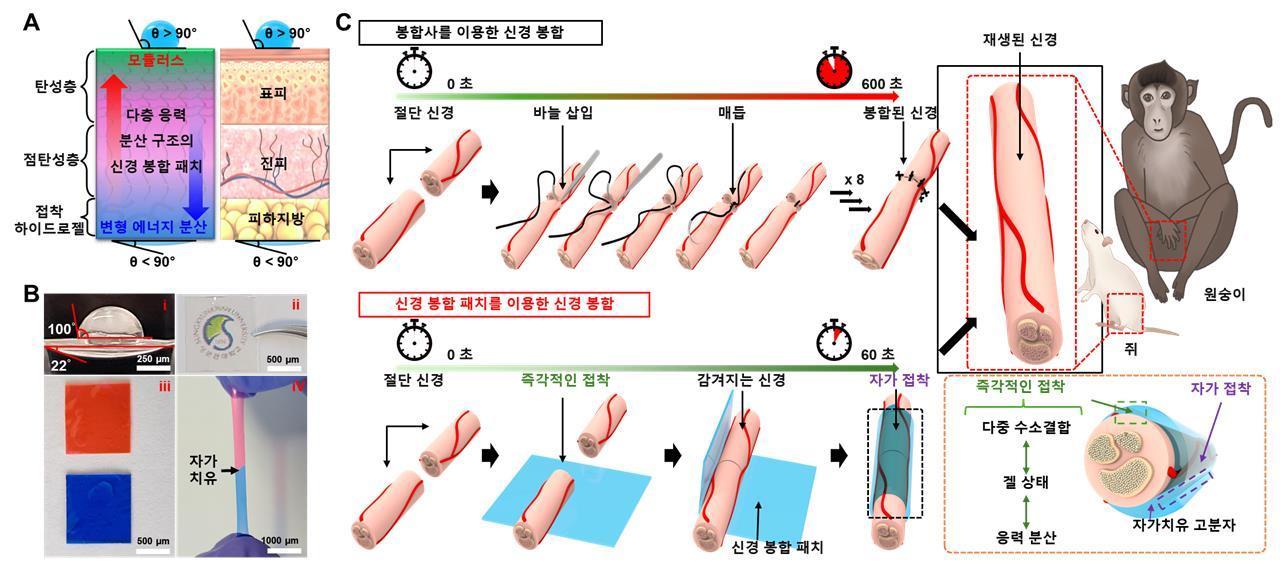 신경 봉합 패치의 개념도 및 적용. &#40;성균관대 제공&#41;/뉴스1