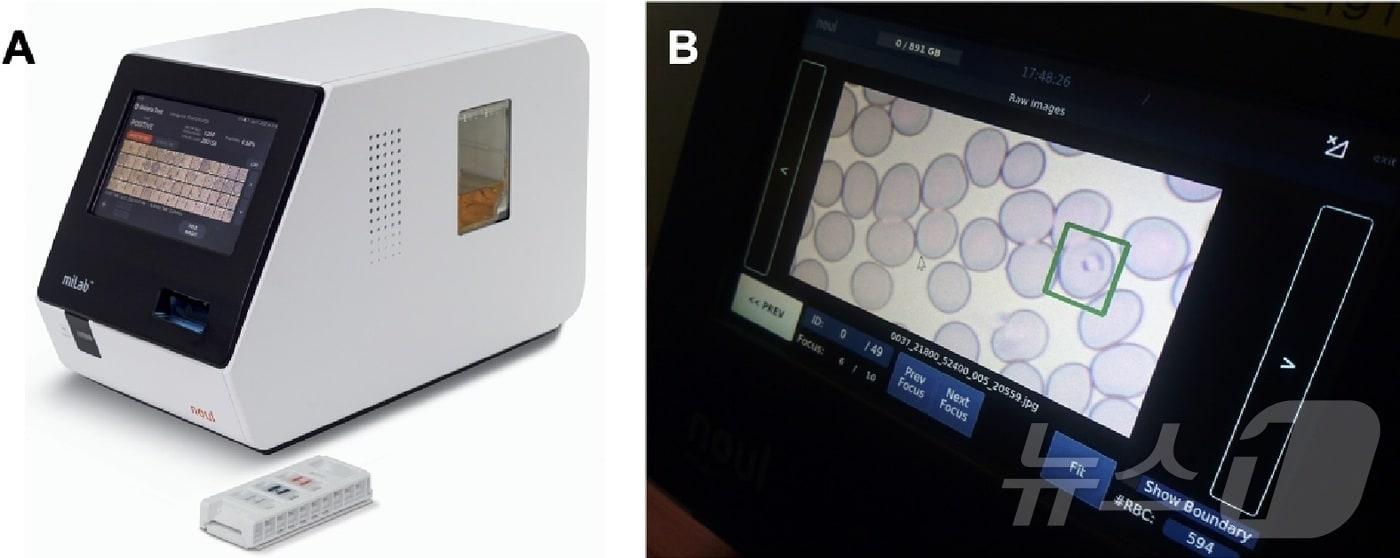 노을의 말라리아 진단기기 마이랩 디바이스와 카트리지 모습. 마이랩을 통해 분석한 기생충 감염 적혈구를 화면에서 직접 볼 수 있다.&#40;노을 제공&#41;/뉴스1 ⓒ News1