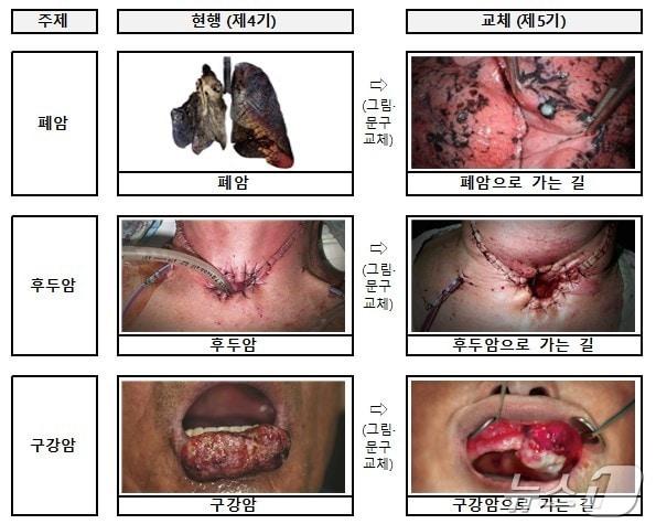 제5기 담뱃갑 경고그림 및 문구 표기내용&#40;보건복지부 제공&#41;