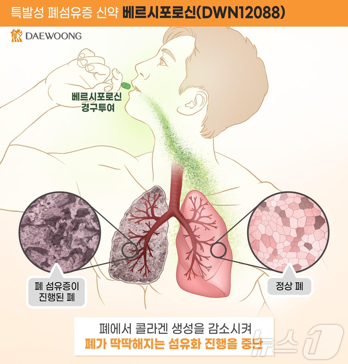 대웅제약 제공