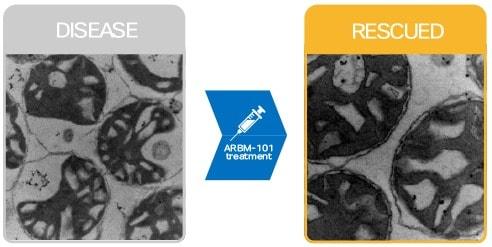 아보메드가 전임상에서 윌슨병 질환 설치류 동물모델에 ARBM-101을 투약한 후 간세포 내 미토콘드리아가 활성을 회복하는 것을 확인했다.&#40;아보메드 제공&#41;/뉴스1 ⓒ News1