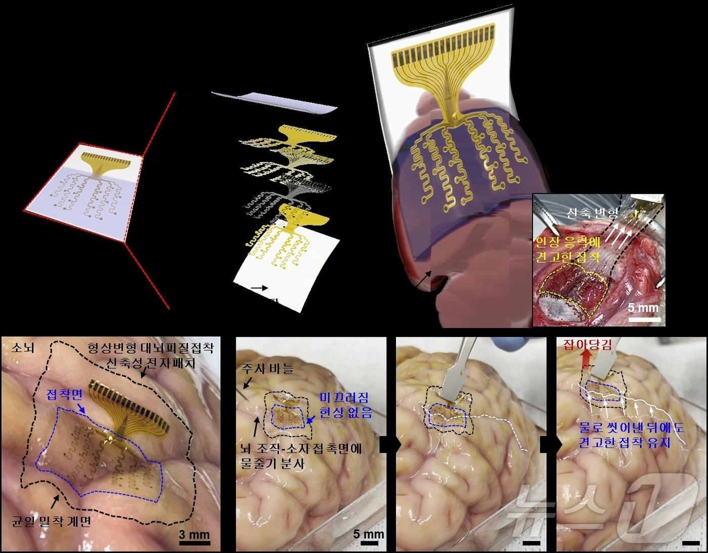 형상변형 대뇌피질접착 신축성 전자패치 개요 및 견고한 뇌 부착력. &#40;기초연 제공&#41;/뉴스1