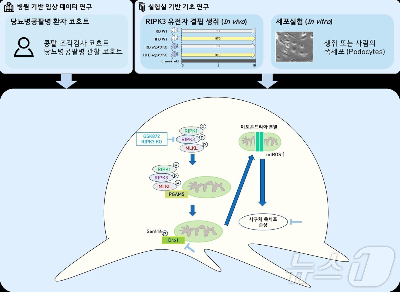 당뇨병콩팥병에서 RIPK3를 타깃으로 하는 새로운 치료 전략. &#40;순천향대 천안병원 제공&#41; /뉴스1