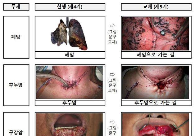 '폐암으로 가는 길' 담뱃갑 경고 더 세진다…23일부터 새 그림 적용