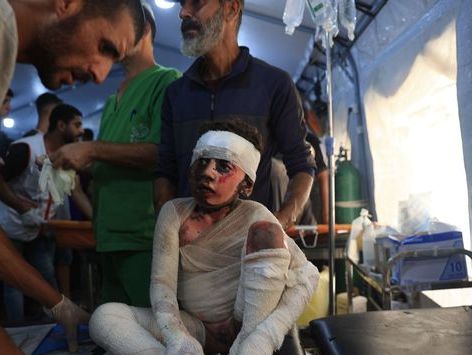[포토] 온 몸에 붕대 감은 소녀…가자지구 폭격 사상자 속출