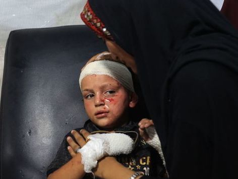 [포토] 가자지구 수용소 폭격에 부상 당한 팔레스타인 소녀